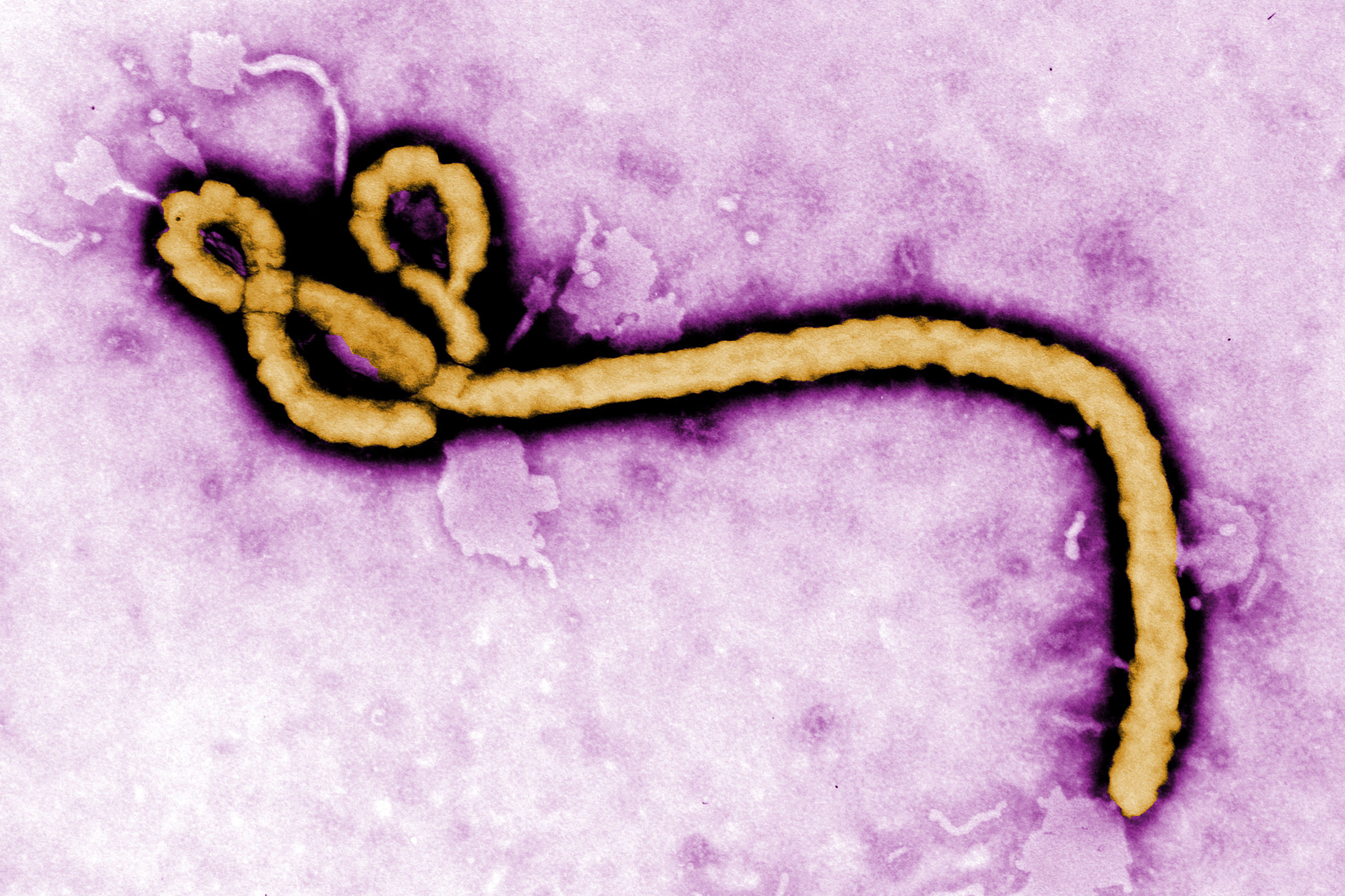 Scientists apply optical pooled CRISPR screening to identify potential new Ebola drug targets | MIT News