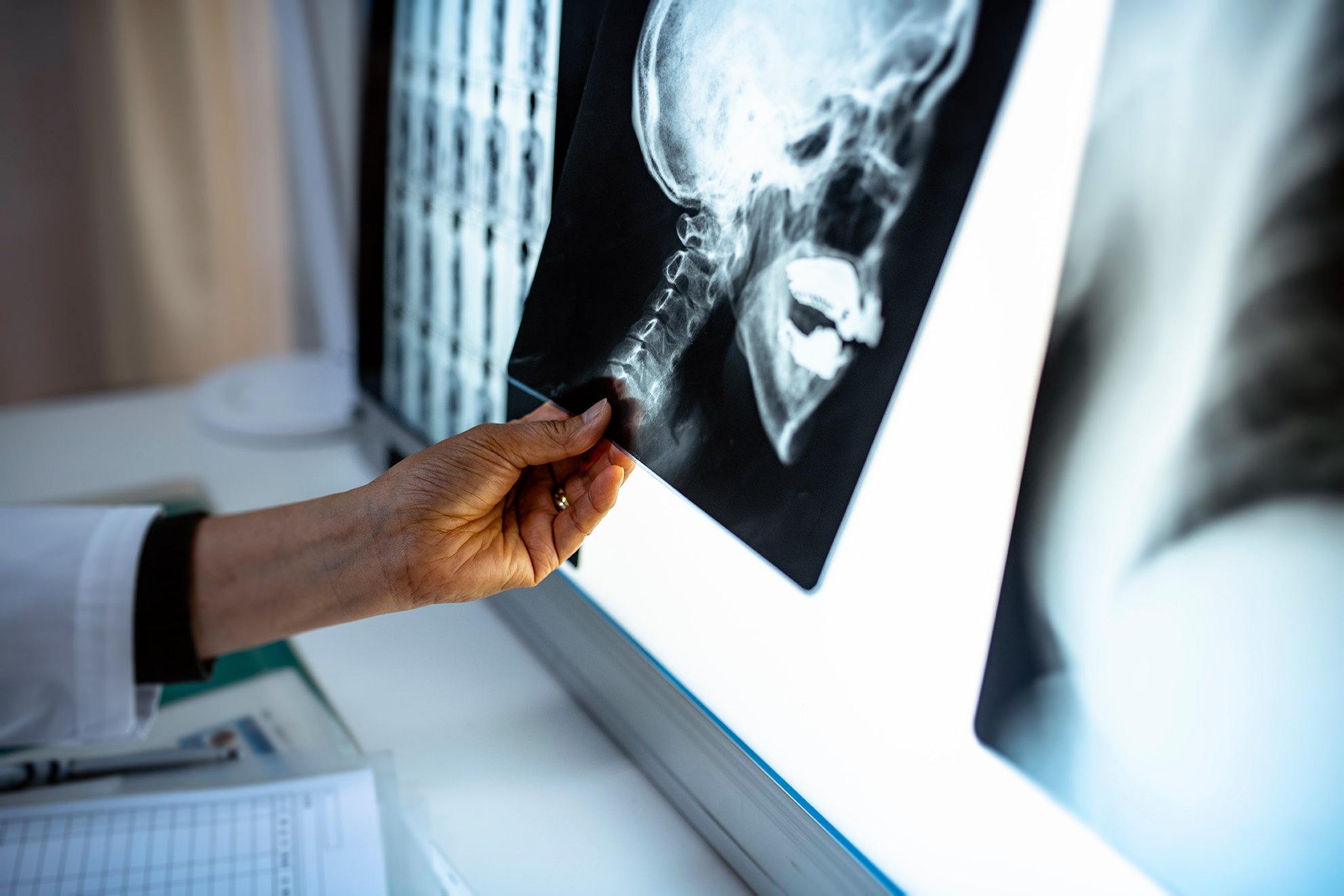 Promising HSDM research into the rare and debilitating disease was halted due to withdrawal of federal funding. The research had implications for treating a range of skeletal conditions and broader medical applications.